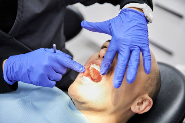 Best Emergency Treatment for Dental Infections or Abscesses in Clearlake, CA